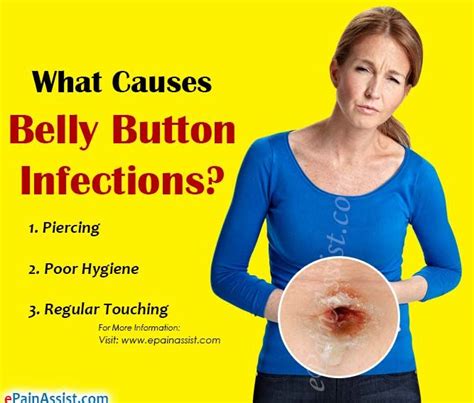 can a belly button infection kill you|What to Do About a Belly Button Infection 